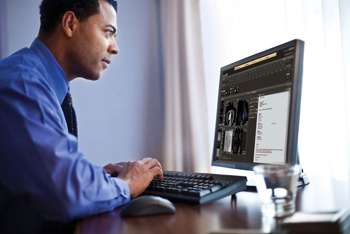 IntelliSpace Cardiovascular unterst&uuml;tzt schnelle und genaue Diagnosestellung​