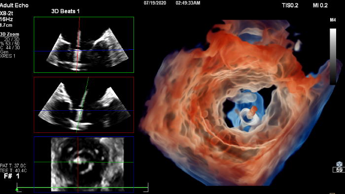 Cardiovascular Ultrasound