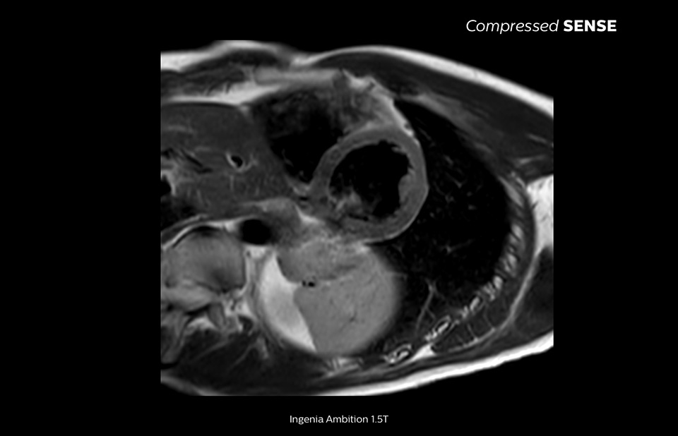 12&nbsp;s Atemanhalten