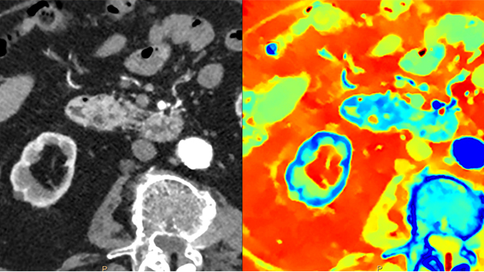 Photonenz&auml;hlung