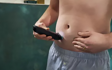 Wie entfernt man einen Happy Trail?